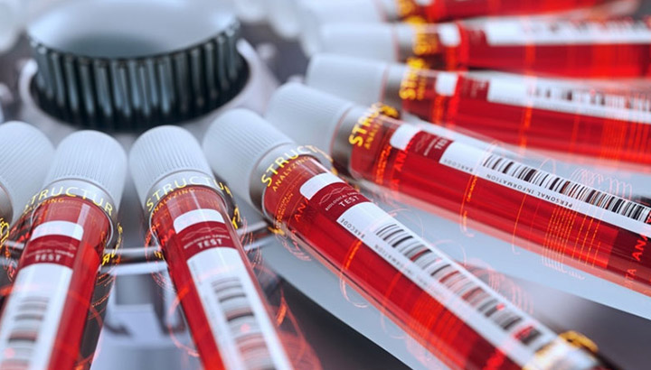 Application de la centrifugation dans l'industrie pharmaceutique